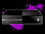 6 Awesome Xbox One Facts! -- Fact Surgery tn